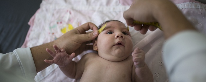 Zika: `Quick test` for virus linked to brain damage in babies developed in Texas
